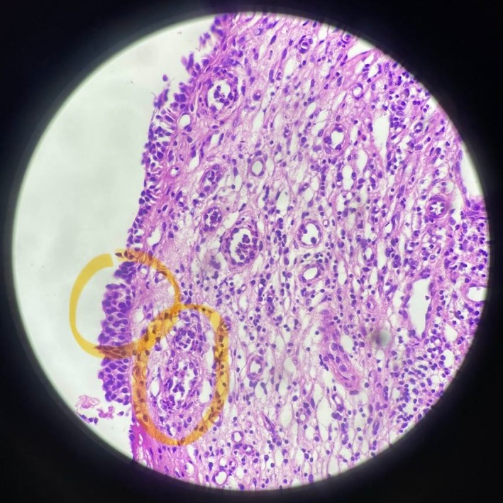 FIGURE 5