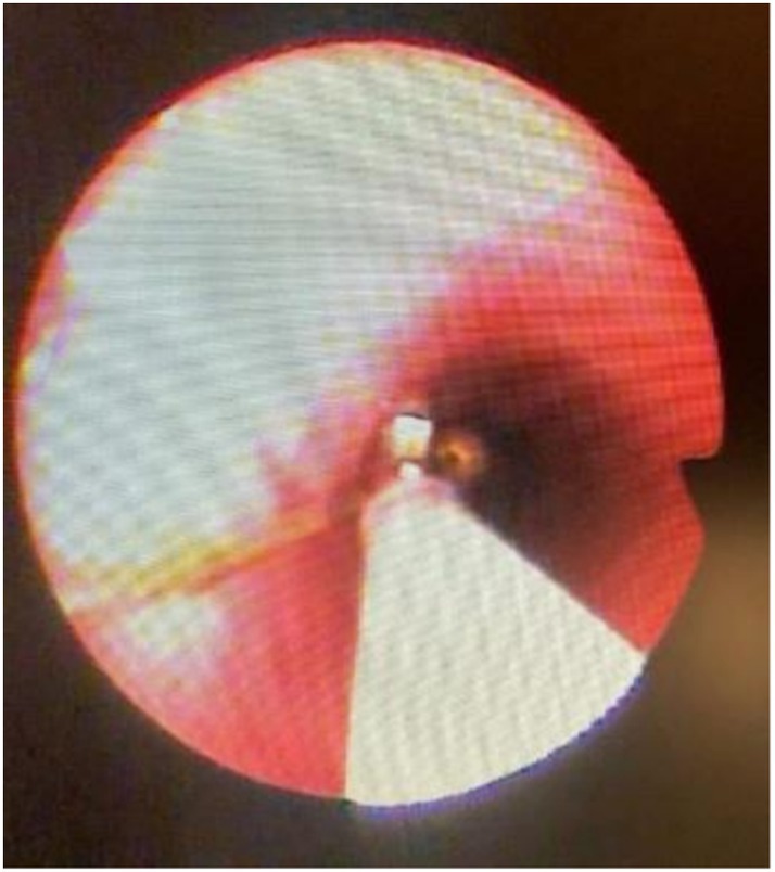 FIGURE 3