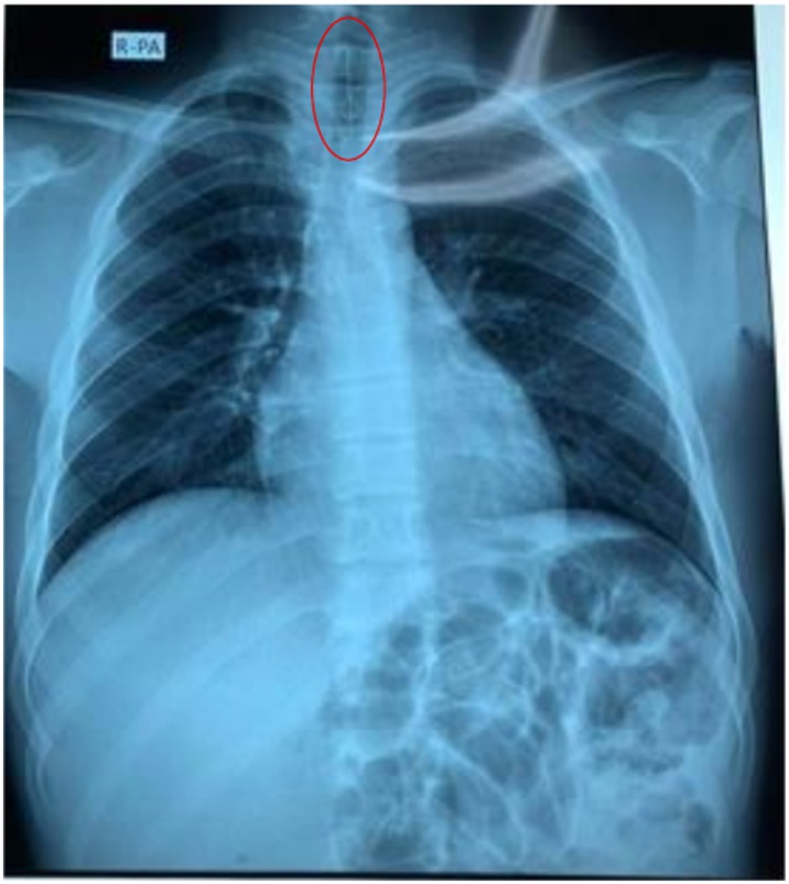 FIGURE 1