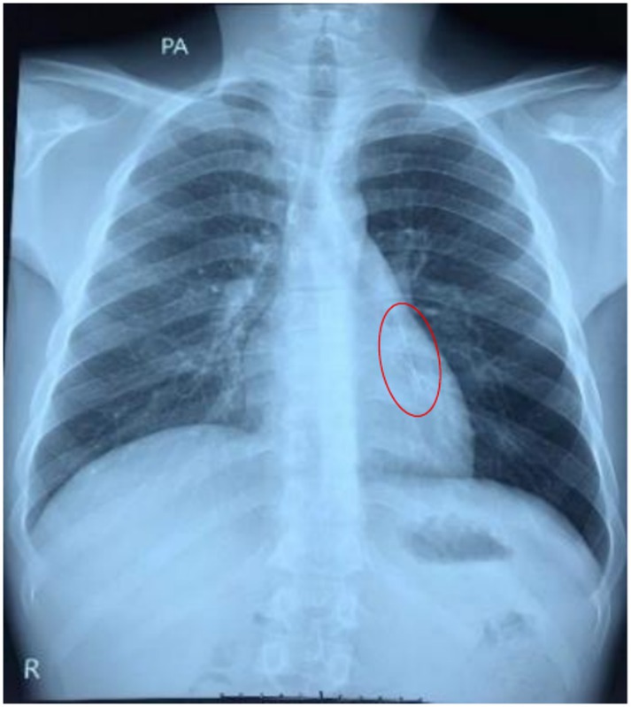 FIGURE 2