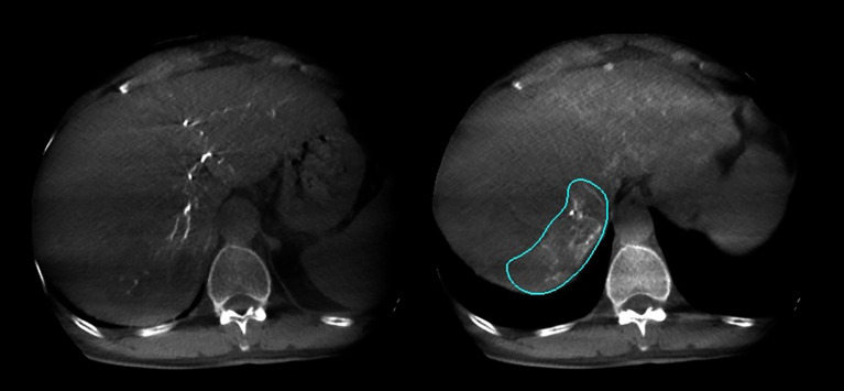 Figure 2