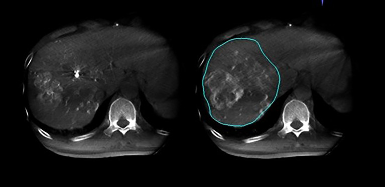 Figure 3