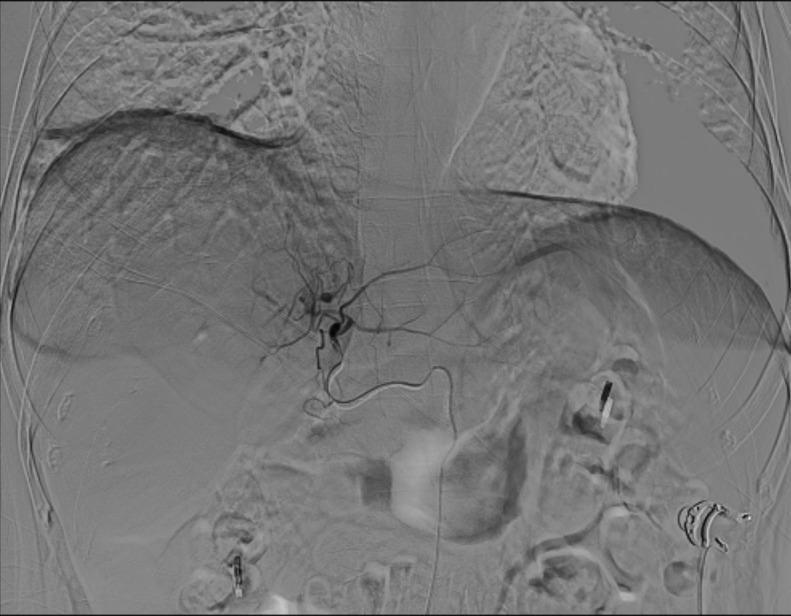 Figure 4