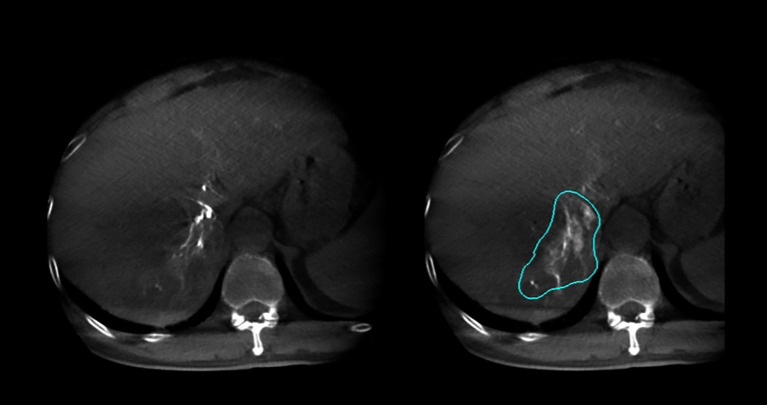 Figure 6