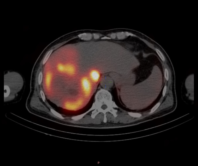 Figure 10