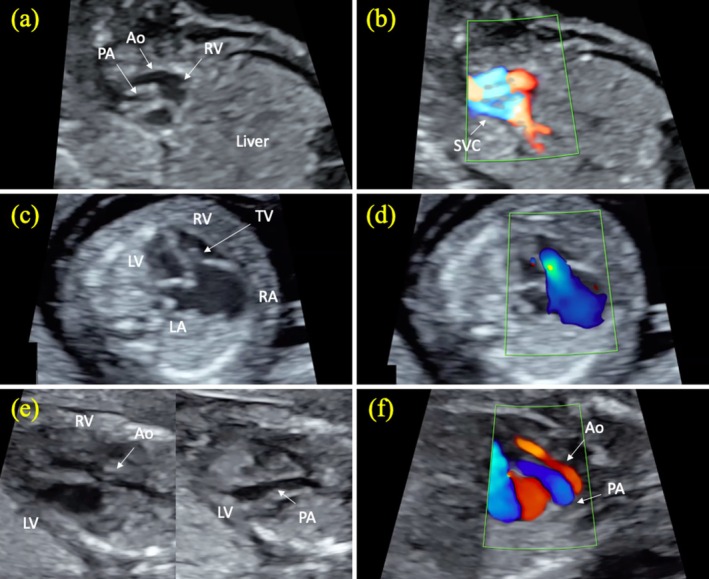 FIGURE 3