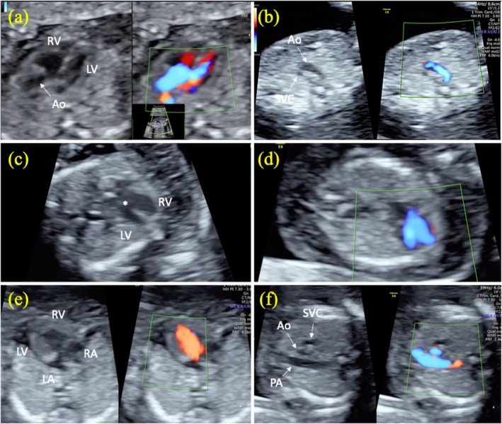 FIGURE 2