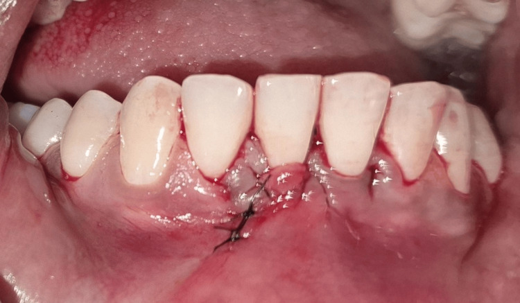 Figure 10