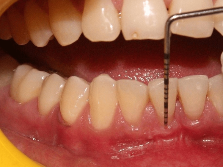Figure 12