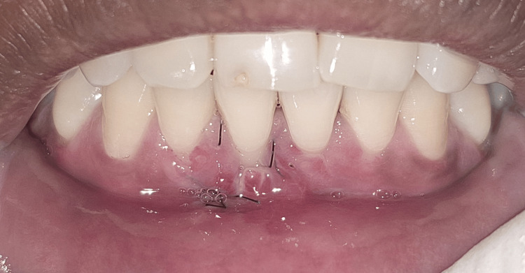 Figure 13