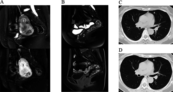 FIGURE 2