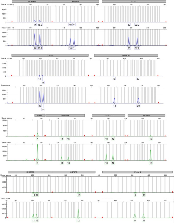 FIGURE 4