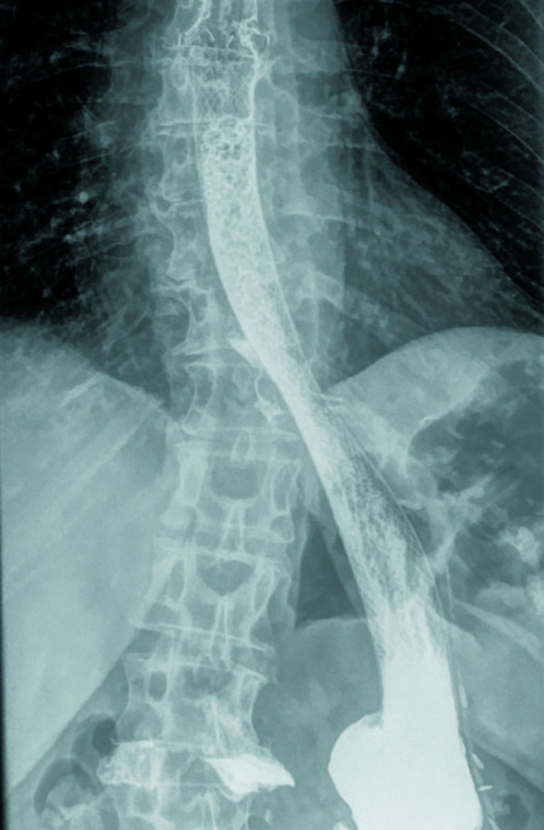 FIGURE 3