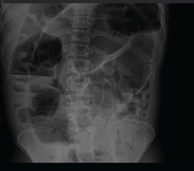 FIGURE 1