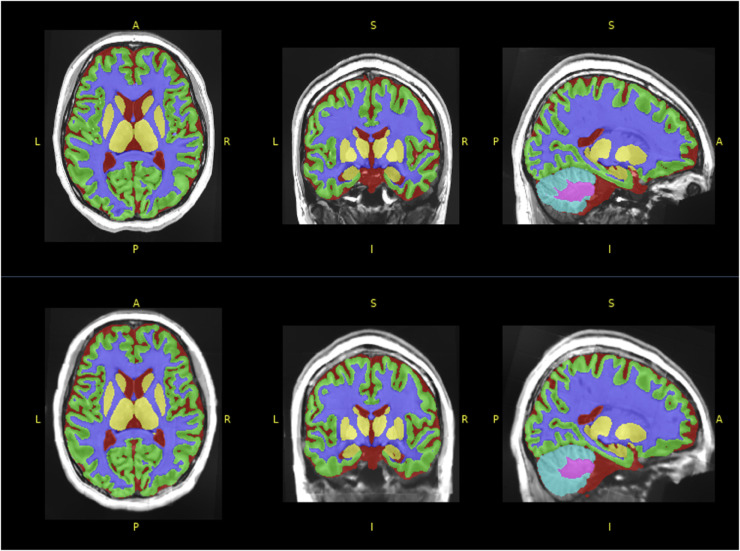 Fig 7