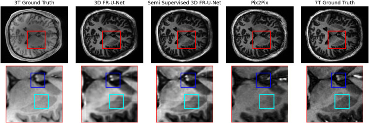 Fig 8
