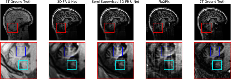 Fig 9