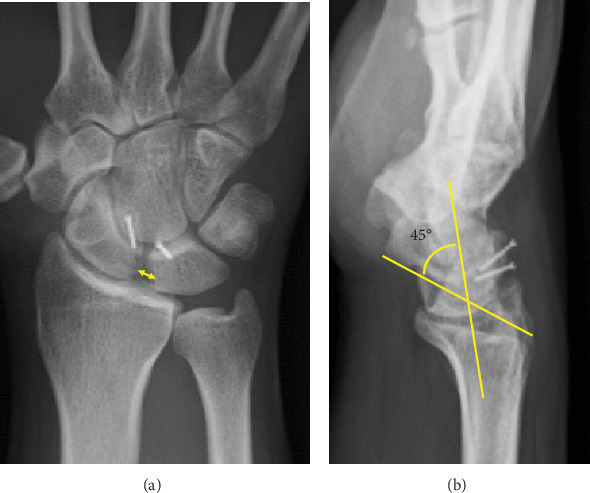 Figure 4