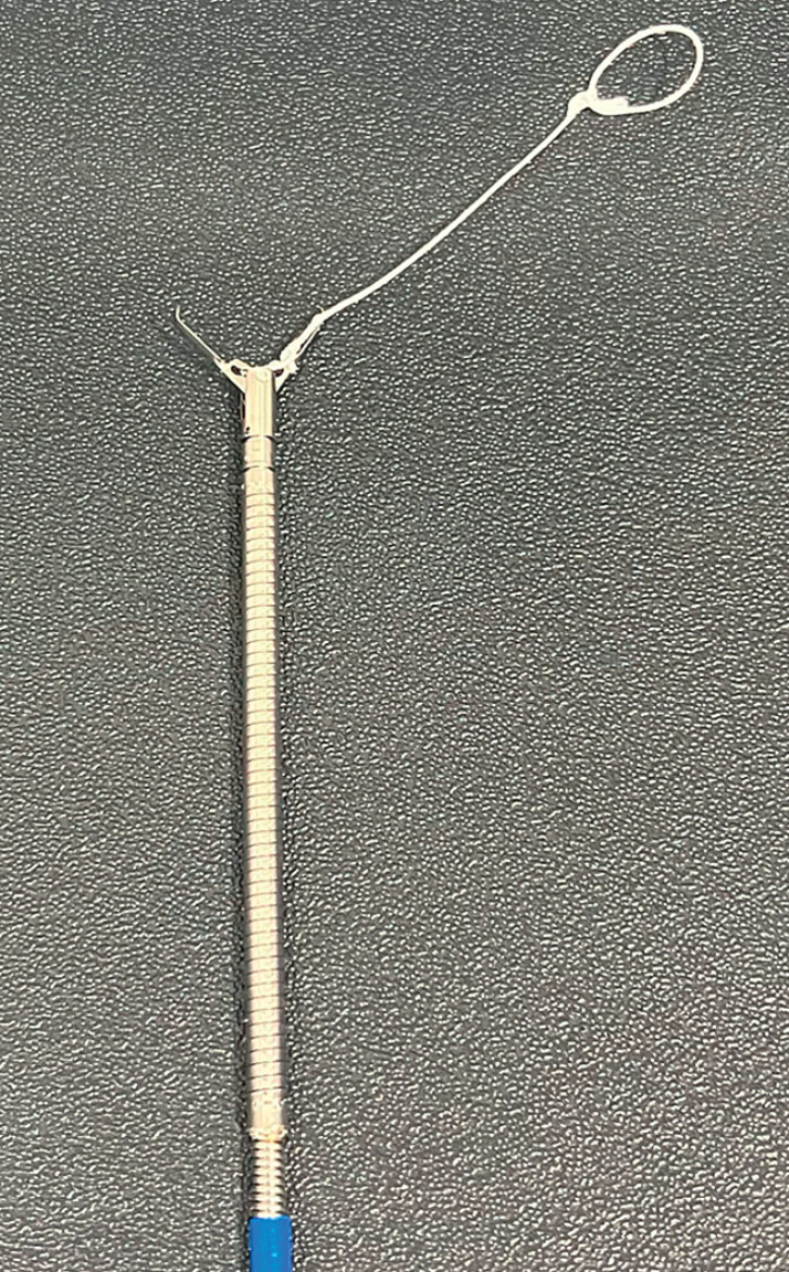 Fig. 2