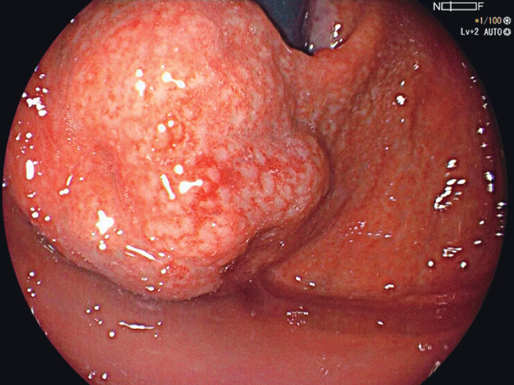 Fig. 2