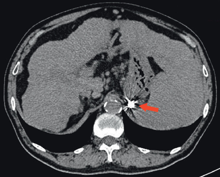 Fig. 5
