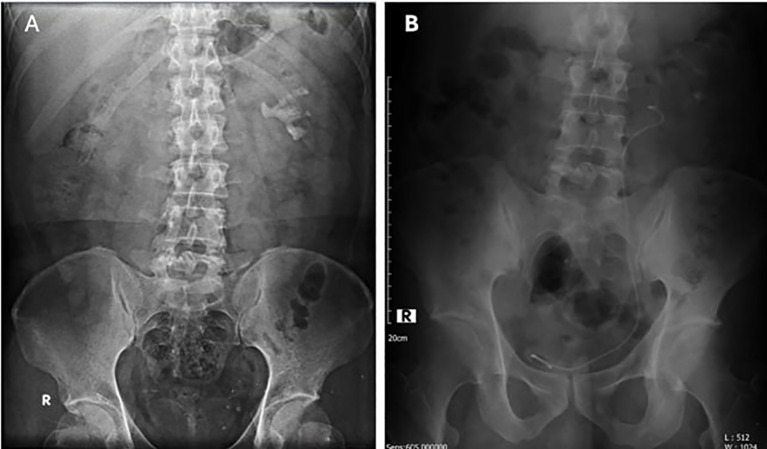 Figure 1