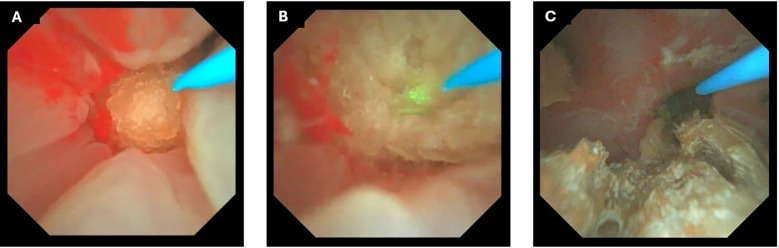 Figure 3