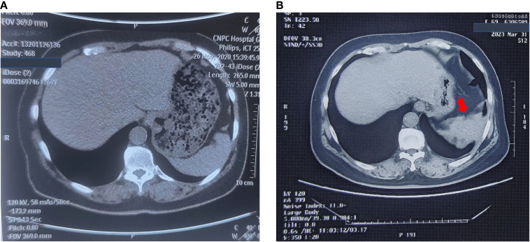 Figure 1