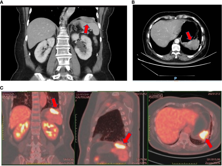 Figure 2