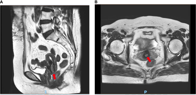 Figure 4