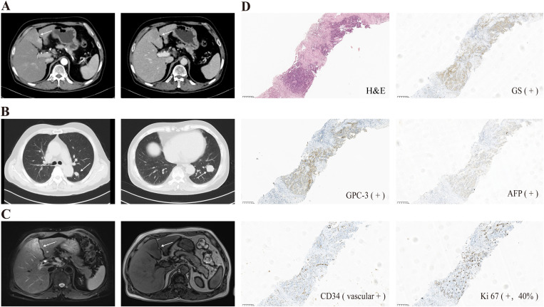 Figure 1