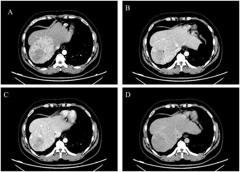 Figure 1