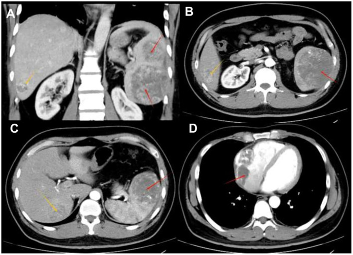 Figure 1