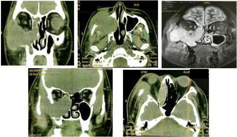 Figure 1
