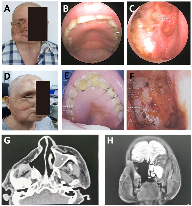 Figure 3