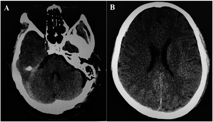 Figure 2