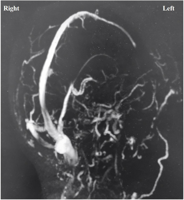Figure 3