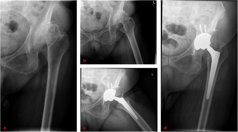 Figure 4