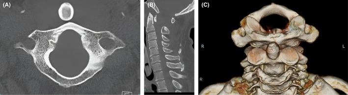 FIGURE 3