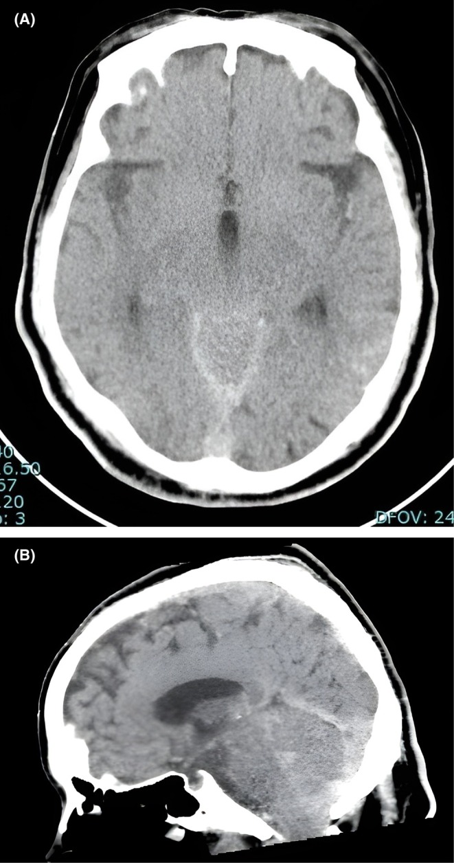 FIGURE 2