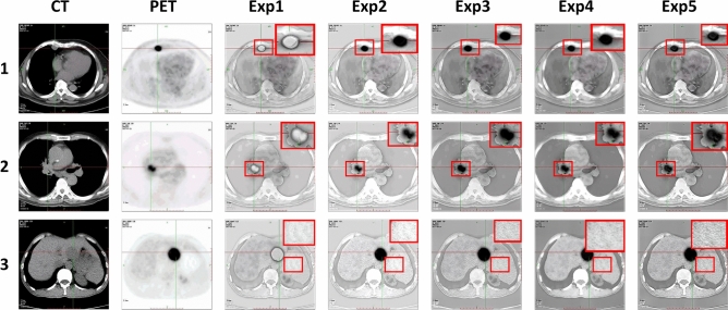 Figure 12