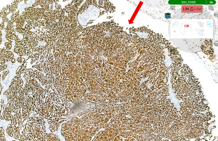 Figure 6