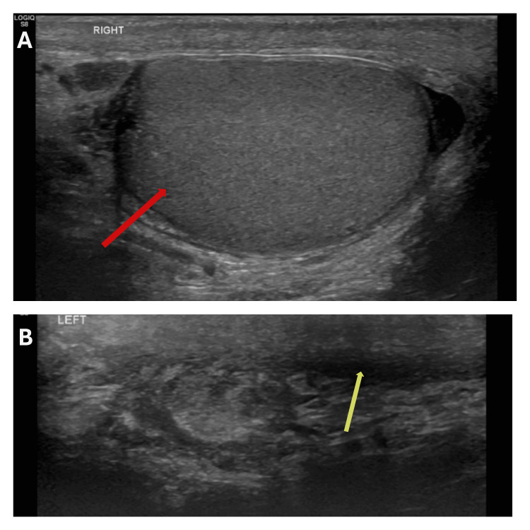 Figure 9
