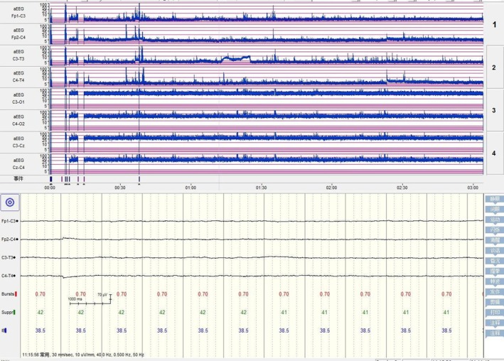 FIGURE 2