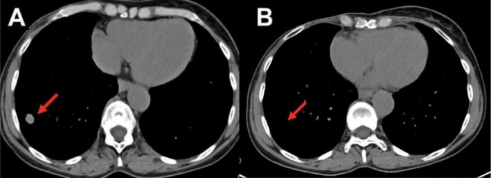FIGURE 1