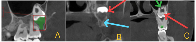 Figure 4