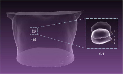 FIGURE 17