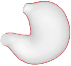 Figure 16