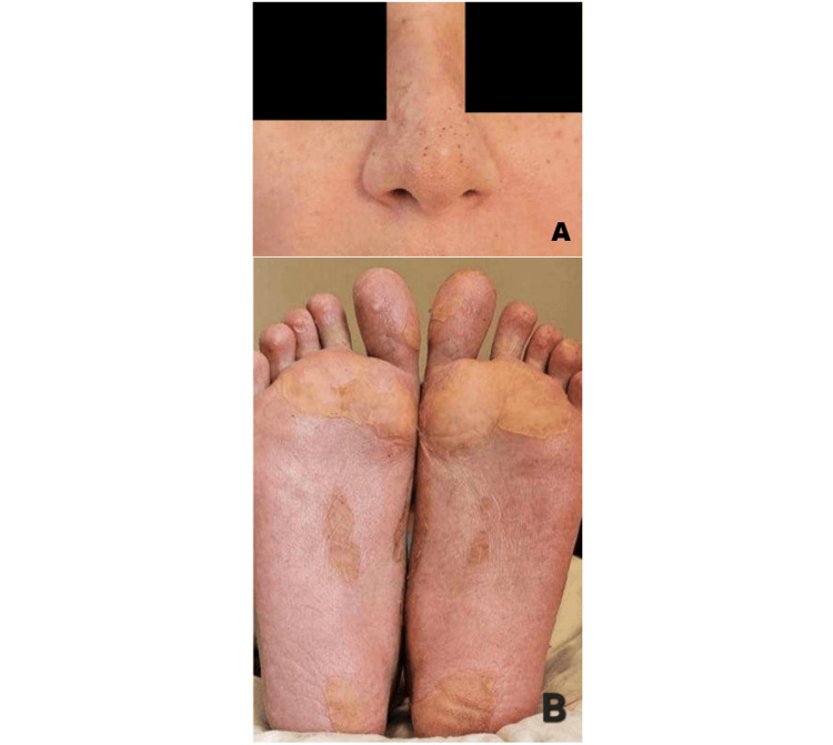 Figure 5