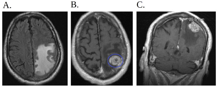 Figure 9